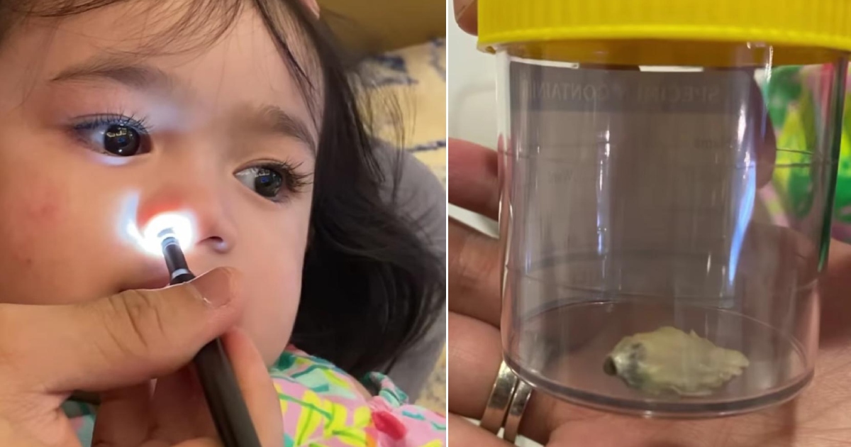 Putik bunga dalam hidung anak Hanis Zalikha