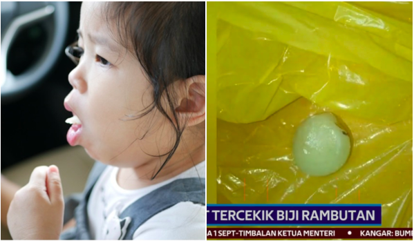 anak tercekik buah