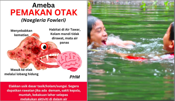 jangkitan makan otak