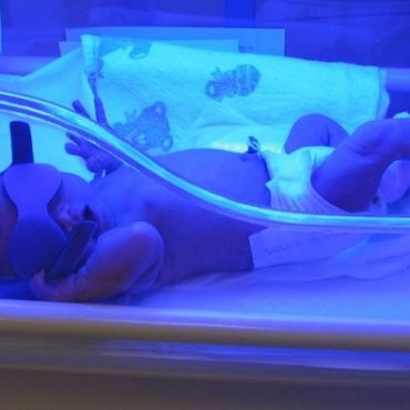 bayi demam kuning