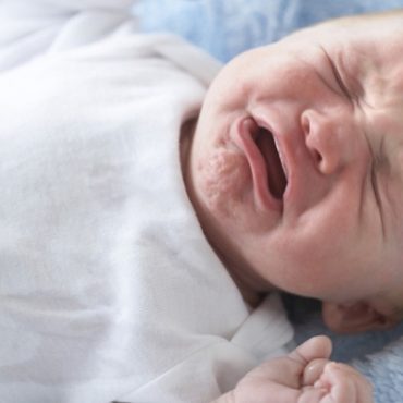 bayi alergi susu formula