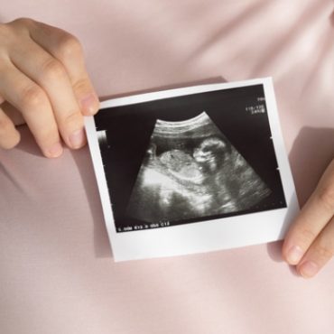DOA BAYI SONGSANG