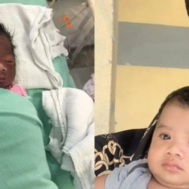kulit bayi gelap jadi cerah