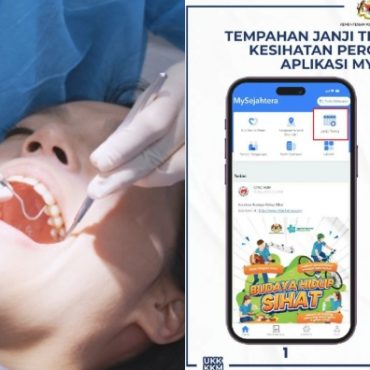 scaling gigi klinik kerajaan