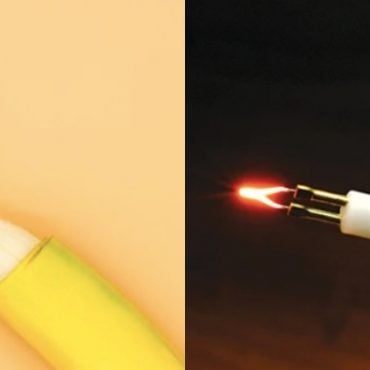 sunat laser