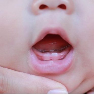 bayi tumbuh gigi demam