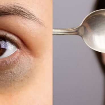 cara hilangkan eye bag