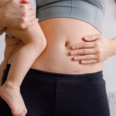 tanda jahitan caesarean terbuka