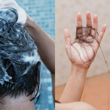 rambut gugur teruk