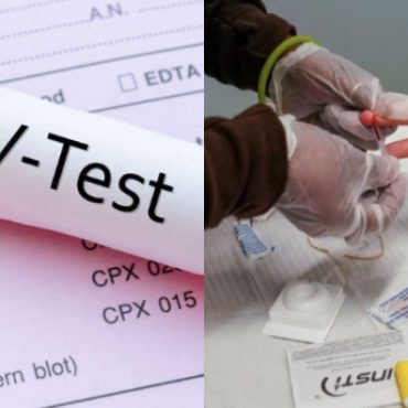 ujian saringan hiv