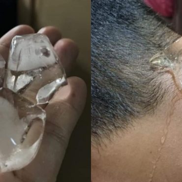 cara hilangkan migrain