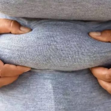 WANITA LEBIH CEPAT GEMUK