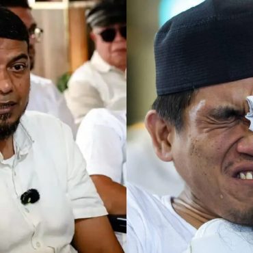 'Abang Belon Berisiko Lumpuh' – Doktor
