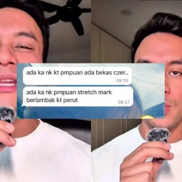 ‘Stretch Marks, Bekas Caesar Bukan Kecacatan & Kekurangan Tapi Lambang Kekuatan’