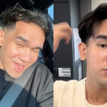 Dituduh Membazir Buat Rawatan Muka Di Korea Selatan, Farez Adnan Respon – ‘Tak Pakai Duit Kau Pun, Dekat Sana 3 Kali Ganda Lagi Murah’