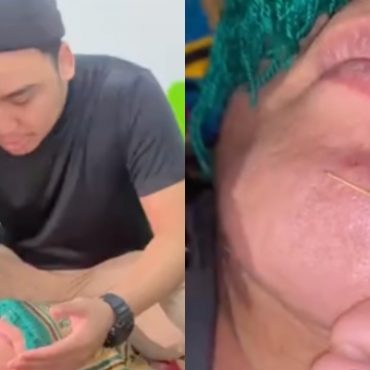 [VIDEO] Artis Lelaki Didakwa Buang Susuk Selepas Niat Taubat – ‘Cuba Pelbagai Kaedah & Habis Ribuan Ringgit Tapi Jarum Tak Nak Keluar’