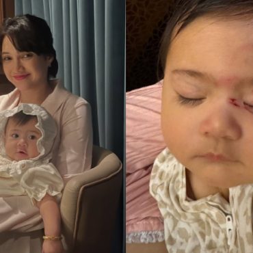Atikah Suhaime Luah Rasa Bersalah, Anak Luka Di Muka Akibat Terjatuh Buaian Elektrik