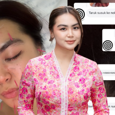 ‘Bukan Susuk Lah, Tapi Rawatan Akupuntur’ – Bella Dowanna