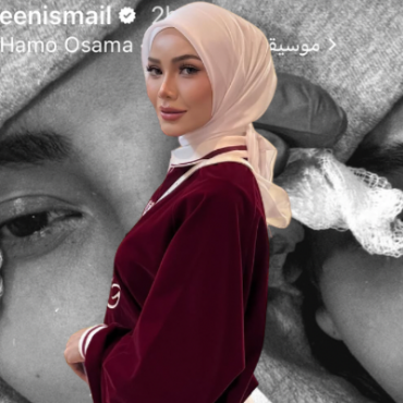 Aween Ismail Mohon Maaf Terpaksa Batal ‘Photoshoot’, Cedera Di Wajah Akibat Kemalangan
