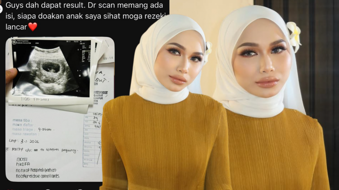 Akaun Palsu Guna Gambar & Nama Iman Troye, Siap Umum Berita Kehamilan