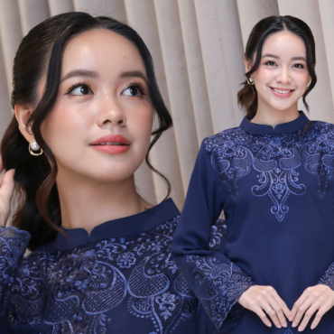 Tracie Sinidol Hampir Buta Sebelah Mata Akibat Terkena Bulu Tangkis, Trauma Main Badminton
