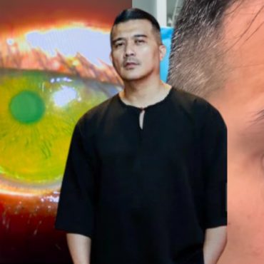[VIDEO] Aaron Aziz Alami Kecederaan Mata, Dipercayai Terkena Bola Pickleball