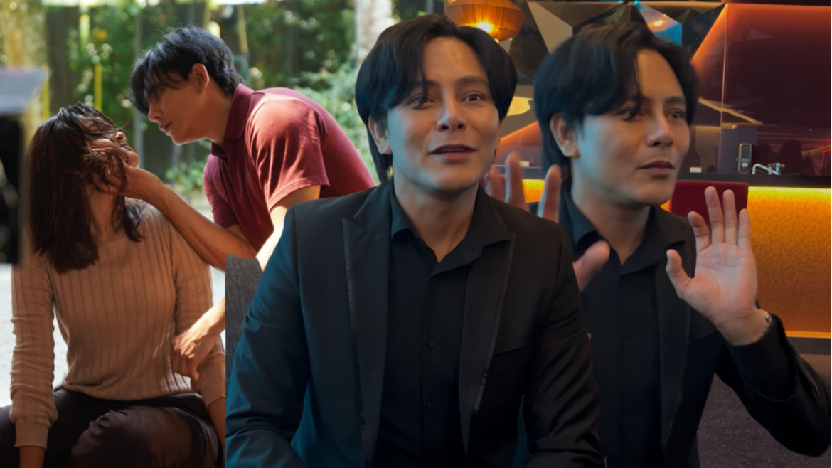 Nazim Othman Tak Sengaja Tercucuk Mata Nia Atasha, Rasa Bersalah Sampai ‘Anxiety’ – ‘Penggambaran Dihentikan Seketika’