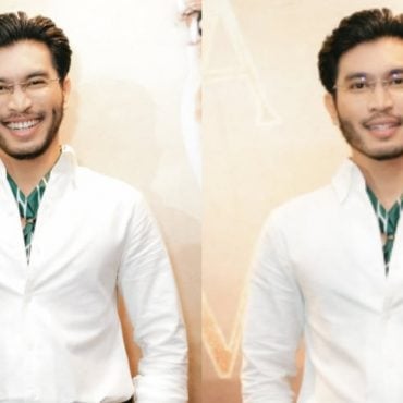 Haidar Hasanudin Buat Beard Transplant – ‘Tanam Untuk Stabilkan Sebab Jambang Tumbuh Sebelah Kanan Saja’